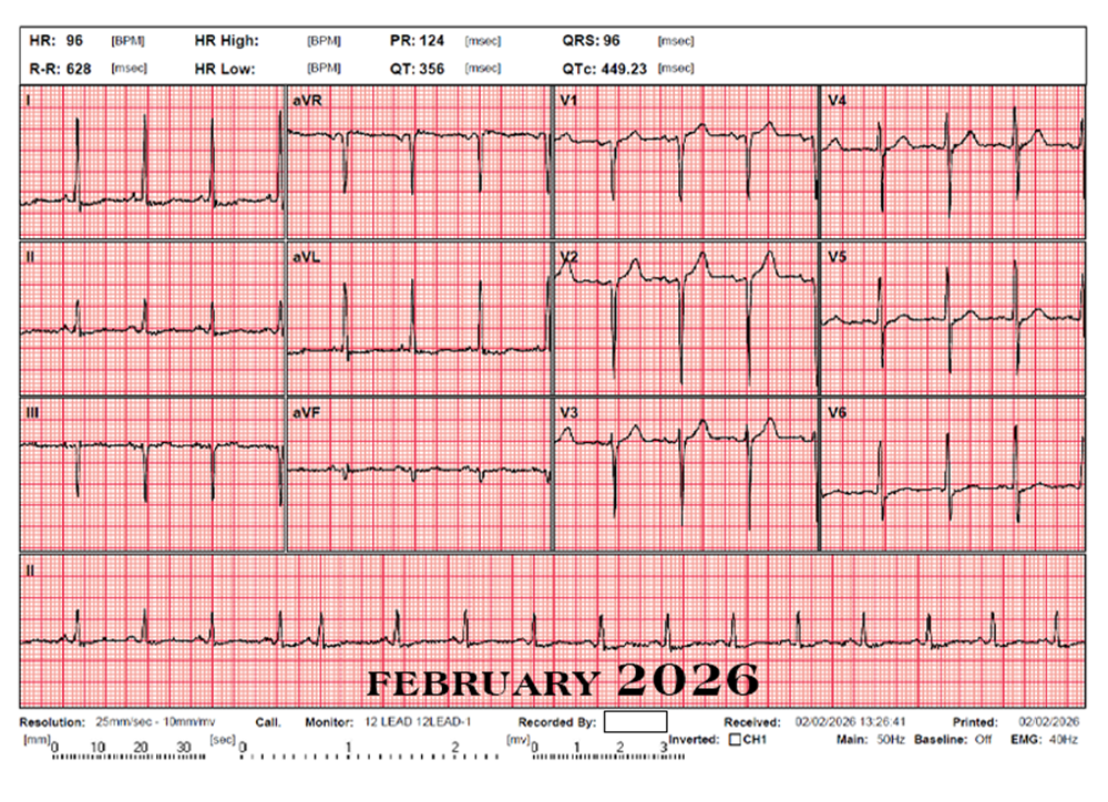 ECG2526_01_03