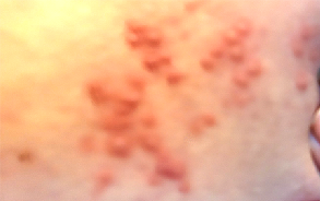skin12 skin12