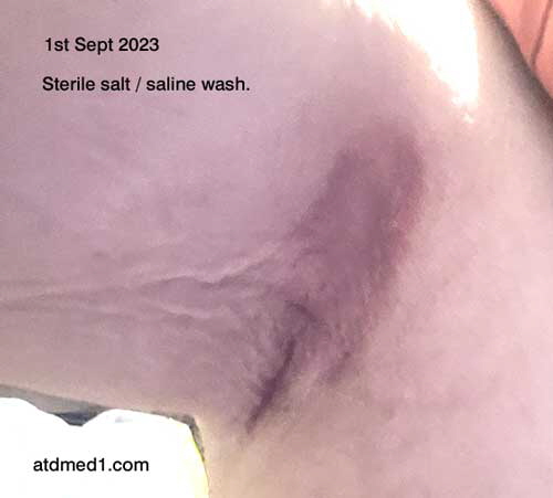 1srSeptLEFT1 1srSeptLEFT1